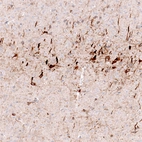 Immunohistochemical staining of mouse cerebral cortex shows strong cytoplasmic positivity in neurons.