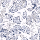 Immunohistochemical staining of human placenta shows no positivity in trophoblastic cells as expected.