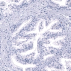 Immunohistochemical staining of human prostate shows no positivity in glandular cells as expected.