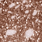 Anti-GPR88 Antibody