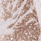 Immunohistochemical staining of mouse caudate nucleus shows moderate positivity in neuronal processes.
