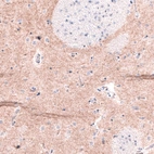 Immunohistochemical staining of human caudate nucleus shows moderate positivity in neuronal processes.