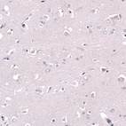 Immunohistochemical staining of human cerebral cortex shows no positivity in neuropil as expected.