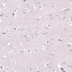 Immunohistochemical staining of human cerebral cortex shows no positivity in neuropil as expected.