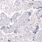 Immunohistochemical staining of human placenta shows no positivity in trophoblastic cells as expected.