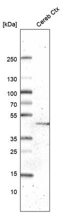 Western blot analysis in human cerebral cortex tissue.