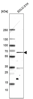 Anti-ETV1 Antibody