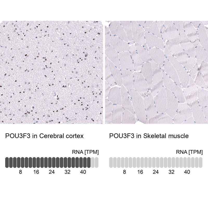Anti-POU3F3 Antibody