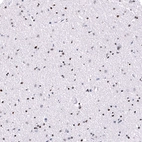 Immunohistochemical staining of human cerebral cortex shows moderate to strong nuclear positivity in neurons and glial cells.