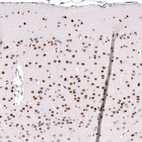 Immunohistochemical staining of mouse cerebral cortex shows strong nuclear positivity in neurons.