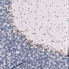 Immunohistochemical staining of mouse cerebellum shows strong nuclear positivity in a subset of neurons.