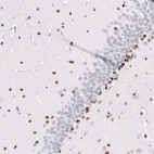 Immunohistochemical staining of rat hippocampus shows moderate to strong nuclear positivity in a subset of neurons.