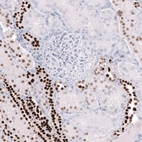 Immunohistochemical staining of human kidney shows moderate to strong nuclear positivity in cells in tubules.