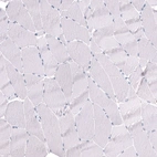 Immunohistochemical staining of human skeletal muscle shows no positivity in myocytes as expected.
