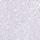 Immunohistochemical staining of human liver shows no positivity in hepatocytes as expected.