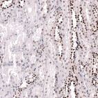 Immunohistochemical staining of human kidney shows strong nuclear positivity in cells in tubules.