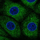 Immunofluorescence staining in MCF7 cell line with Anti-PDIA3 monoclonal antibody, showing specific staining of endoplasmic reticulum in green. Microtubule- and nuclear probes are visualized in red and blue respectively (where available).