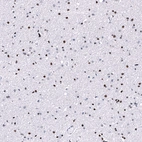 Immunohistochemical staining of human cerebral cortex shows strong nuclear positivity in neurons and glial cells.