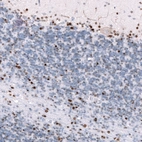 Immunohistochemical staining of human cerebellum shows strong nuclear positivity in granular layer and molecular layer cells.