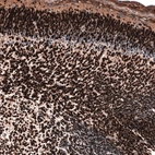 Immunohistochemical staining of mouse embryo, E14 shows strong nuclear positivity in neurons in developing cerebral cortex.