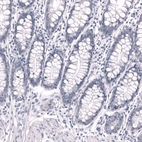 Immunohistochemical staining of human rectum shows no positivity in glandular cells as expected.