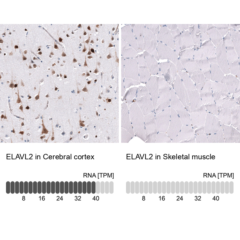 Anti-ELAVL2 Antibody