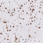 Immunohistochemical staining of human cerebral cortex shows strong cytoplasmic positivity in neurons.