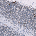 Immunohistochemical staining of human cerebellum shows strong cytoplasmic positivity in a subset of neurons in the granular layer.