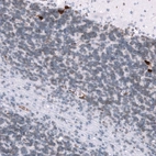 Immunohistochemical staining of human cerebellum shows strong cytoplasmic positivity in a subset of neurons in the granular layer.