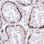 Immunohistochemical staining of human testis shows strong cytoplasmic positivity in a subset of cells in seminiferous ducts.