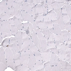 Immunohistochemical staining of human skeletal muscle shows no positivity in myocytes as expected.