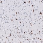 Immunohistochemical staining of rat cerebral cortex shows strong cytoplasmic positivity in a subset of neurons.
