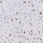 Immunohistochemical staining of rat cerebral cortex shows strong cytoplasmic positivity in a subset of neurons.