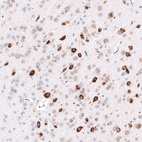 Immunohistochemical staining of mouse cerebral cortex shows strong cytoplasmic positivity in neurons.