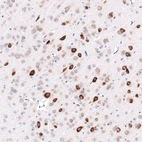 Immunohistochemical staining of mouse cerebral cortex shows strong cytoplasmic positivity in neurons.