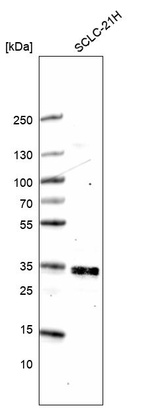 Western blot analysis in human cell line SCLC-21H.