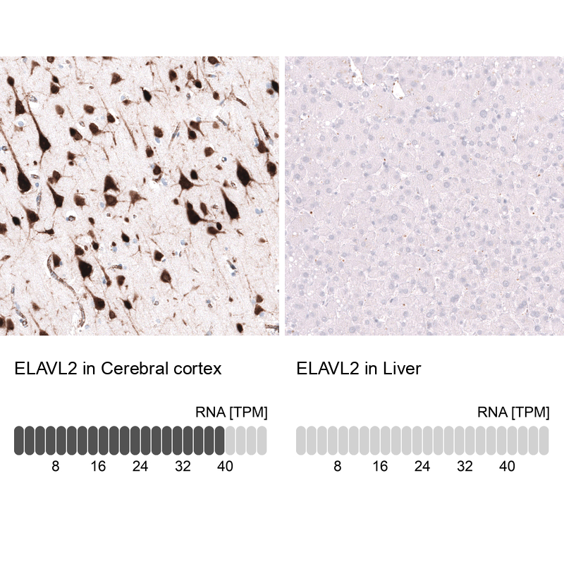 Anti-ELAVL2 Antibody