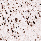 Immunohistochemical staining of human cerebral cortex shows strong cytoplasmic positivity in neurons.