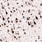 Immunohistochemical staining of human cerebral cortex shows strong cytoplasmic positivity in neurons.
