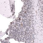 Immunohistochemical staining of human cerebellum shows strong cytoplasmic positivity in a subset of neurons in the granular layer.