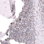 Immunohistochemical staining of human cerebellum shows strong cytoplasmic positivity in a subset of neurons in the granular layer.