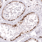 Immunohistochemical staining of human testis shows strong cytoplasmic positivity in a subset of cells in seminiferous ducts.