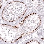 Immunohistochemical staining of human testis shows strong cytoplasmic positivity in a subset of cells in seminiferous ducts.
