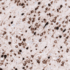 Immunohistochemical staining of rat cerebral cortex shows strong cytoplasmic positivity in neurons.