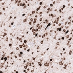 Immunohistochemical staining of rat cerebral cortex shows strong cytoplasmic positivity in neurons.