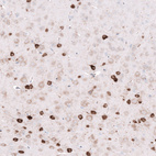 Immunohistochemical staining of mouse cerebral cortex shows strong cytoplasmic positivity in neurons.