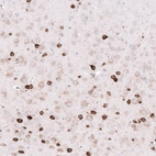Immunohistochemical staining of mouse cerebral cortex shows strong cytoplasmic positivity in neurons.