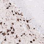 Immunohistochemical staining of rat hippocampus shows strong cytoplasmic positivity in neurons in the dentate gyrus.