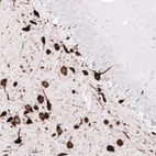 Immunohistochemical staining of rat hippocampus shows strong cytoplasmic positivity in neurons in the dentate gyrus.