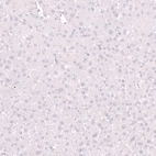 Immunohistochemical staining of human liver shows no positivity in hepatocytes as expected.